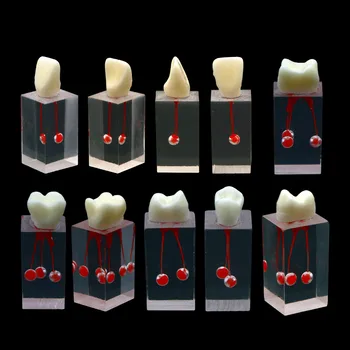 1 шт. модель зубной Эндо блока обучения эндодонтия корневой канал Стоматология педагогической практике медуллярного строения полости прозрачной смолы